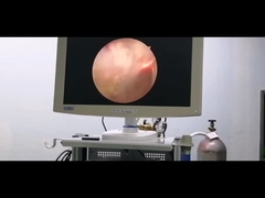 বেনাইন প্রোস্ট্যাটিক হাইপারপ্লাসিয়ার জন্য আরএফ প্লাজমা সার্জারি সিস্টেম ইউরোলজি ইলেকট্রোড